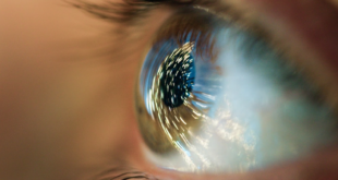 Blurry eyes