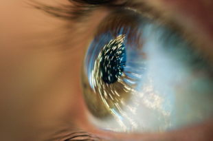Blurry eyes